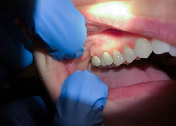 Professional Emergency Dental Service in NJ