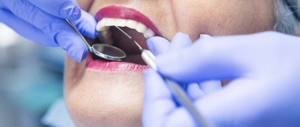 Best Knocked-Out Tooth (Avulsed Tooth) Treatment in Sicklerville, NJ